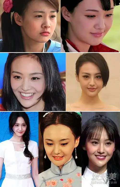 惊悚细数整容不慎走形的女星baby颜值暴跌
