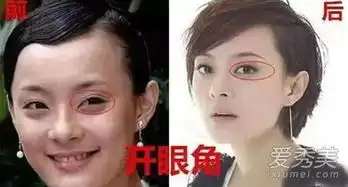 孙俪承认整容从玉观音到芈月传今昔剧照对比
