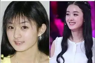 angelababy做面部鉴定盘点娱乐圈10大整容女星
