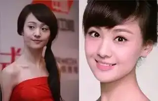 当红女星们的迷之颜值,是整容还是化妆
