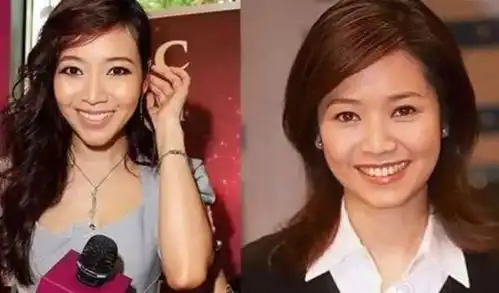 承认整容的14位女星,网友整容不可怕,整丑最尴尬
