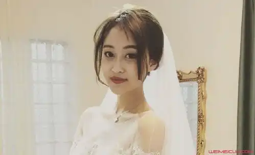 孙侨潞结婚了吗孙侨潞整容前后照片
